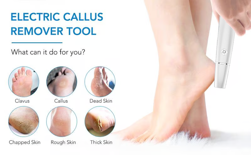 🔥Last Day Special Price £9.99!!💥-🎁Electric Feet Callus Remover