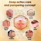 Bee Venom Corn & Callus Remover Cream