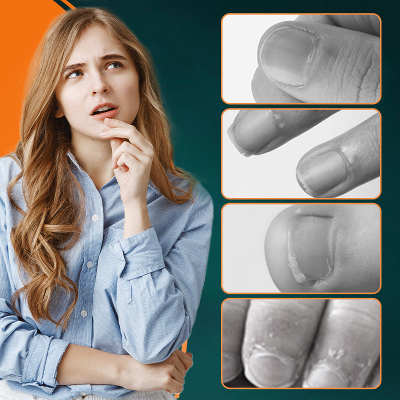 🔥New Hot Sale 50% OFF❤️‍🔥Wide Jaw Opening Anti-Splash Slanted Nail Clipper