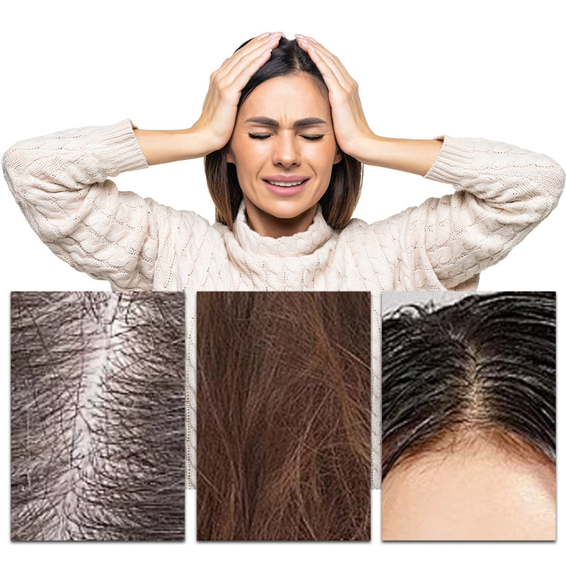 💥Now on sale around the world🔥Newly Developed Deep Moisturizing Conditioner⏲️Limited time offer buy more get more free