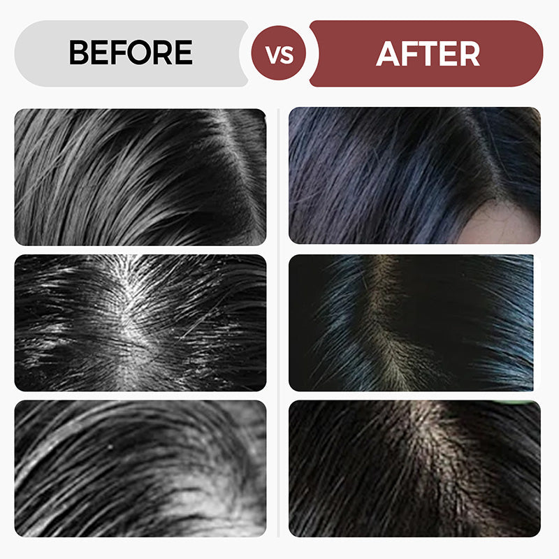 💥Now on sale around the world🔥Newly Developed Deep Moisturizing Conditioner⏲️Limited time offer buy more get more free