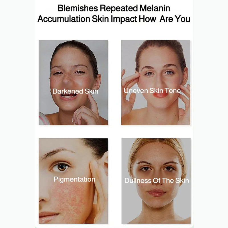 🎅Christmas promotion 49% OFF🎁Radiant Skin Whitening & Spot Correcting Spray