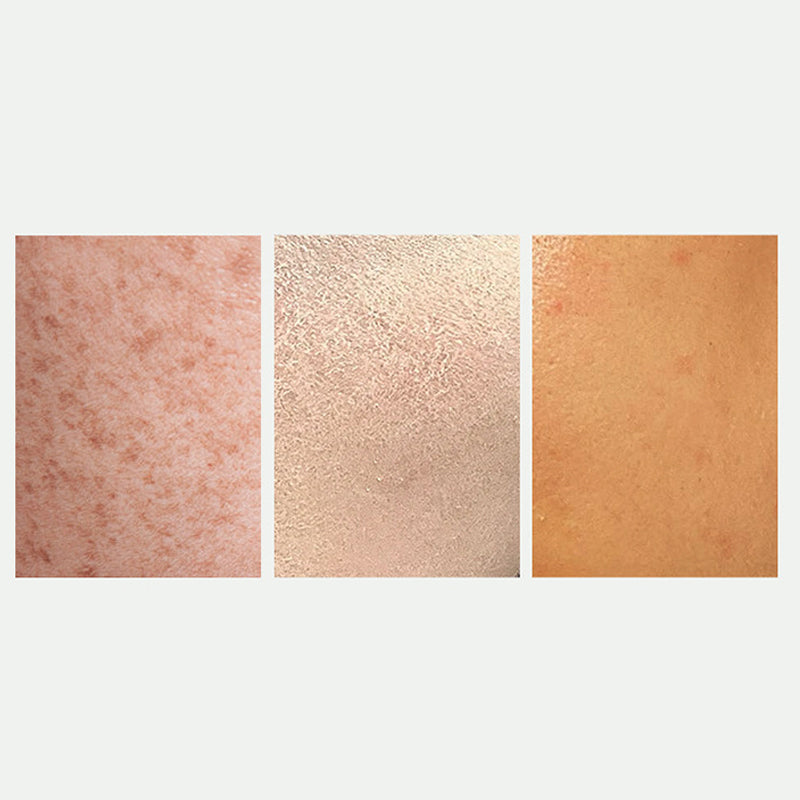 🎅Christmas promotion 49% OFF🎁Radiant Skin Whitening & Spot Correcting Spray